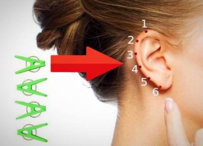 تسکین دردها با فشار دادن نقطه ای خاص روی گوش